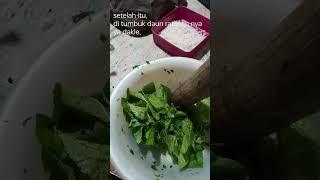 Daun ratusan sebagai obat asam lambung